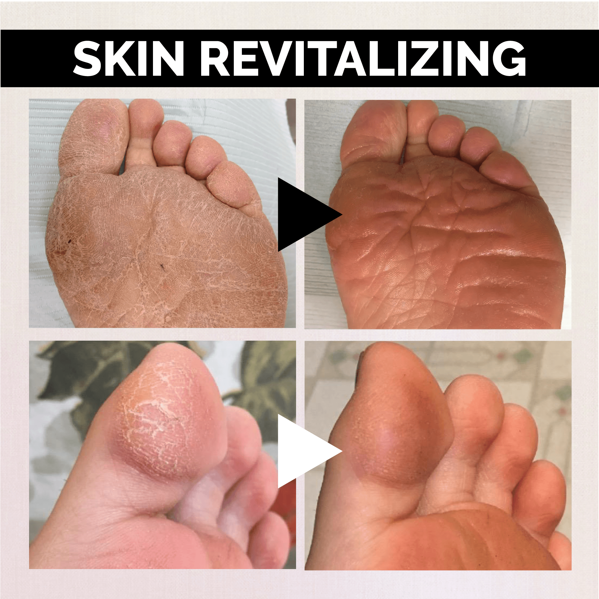 Anti-fungal Exfoliating Foot Soak