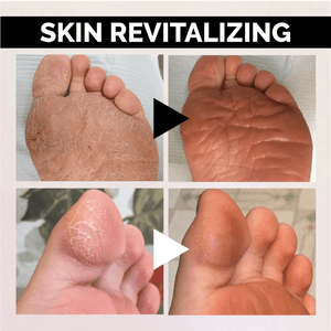 Anti-fungal Exfoliating Foot Soak